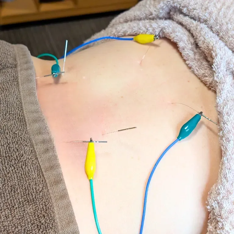 おかやま鍼灸マッサージ院