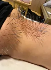 鍼処 たまがわ つくば