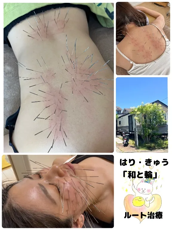 はり・きゅう「和と輪」 ルート治療専門院