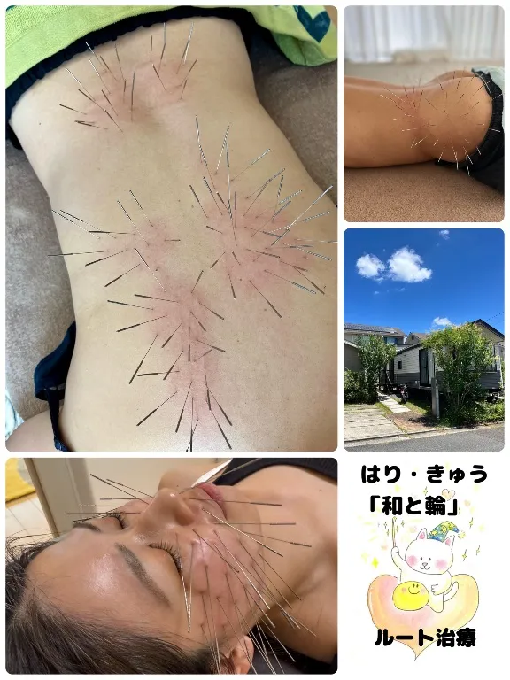 はり・きゅう「和と輪」 ルート治療専門院