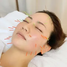 たるみ専門 美容鍼灸 アルバ