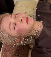 はりのいえ 凪 【ルート治療専門】