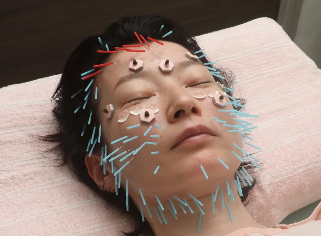おべ鍼灸院