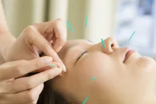 美容鍼 溝口鍼灸整骨院
