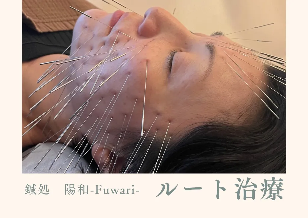 鍼処 陽和 -fuwari- (旧:新栄はりきゅう院)