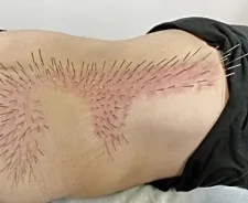 鍼灸サロンれあ