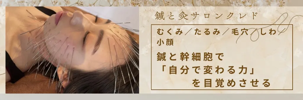 鍼と灸サロンクレド【ルート治療院】大治町本院