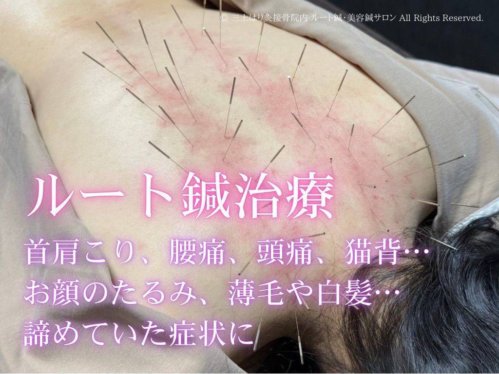 三上はり灸接骨院内 ルート鍼・美容鍼サロン