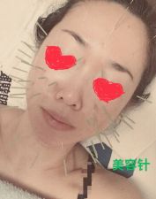 ひかり鍼灸整骨院