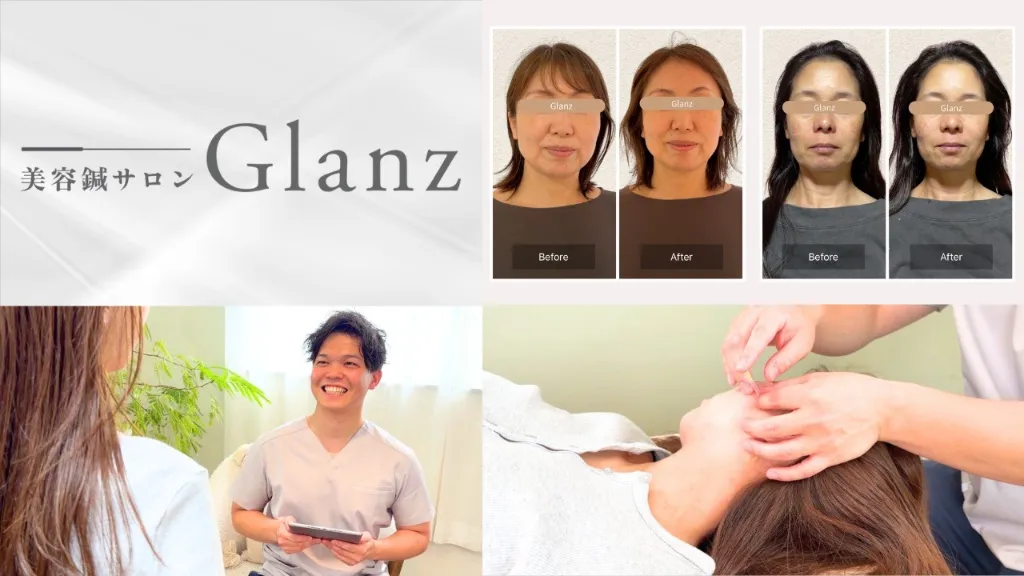 美容鍼サロン Glanz