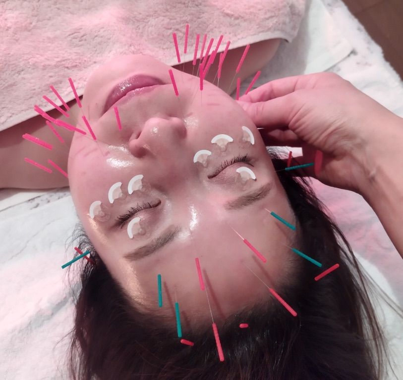 美容鍼灸サロン 漢方美人