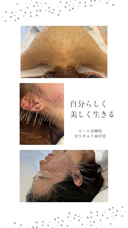はりきゅう春信堂