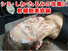 アキュモ鍼灸整体院