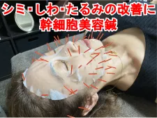 アキュモ鍼灸整体院