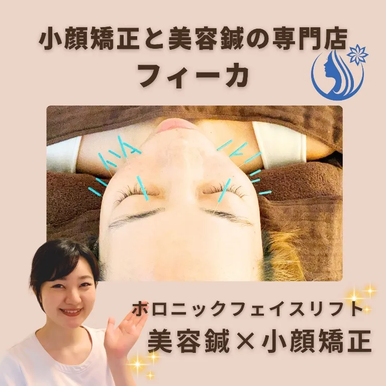 【出張OK/女性専用】小顔矯正と美容鍼の専門店 フィーカ