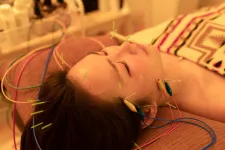 Relama美容鍼✕マッサージ