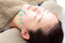 美容鍼灸サロンcotori