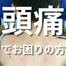 【頭痛でお困りの方】はりきゅう治療院 COVO