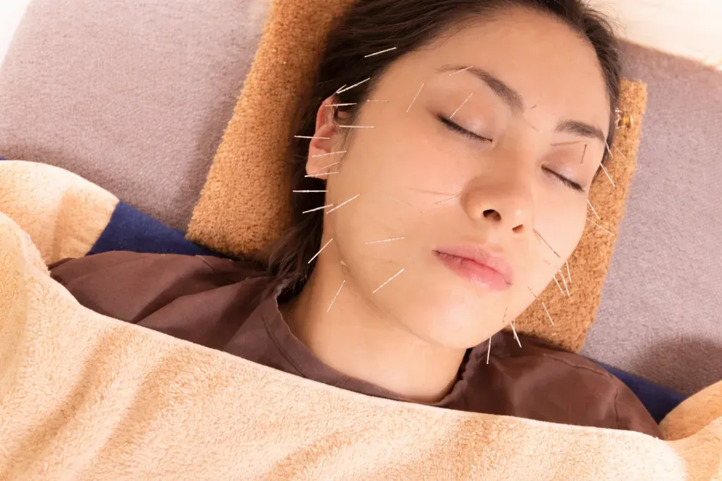 ひがし鍼灸ケアルーム｜顔と首肩を整える美容鍼