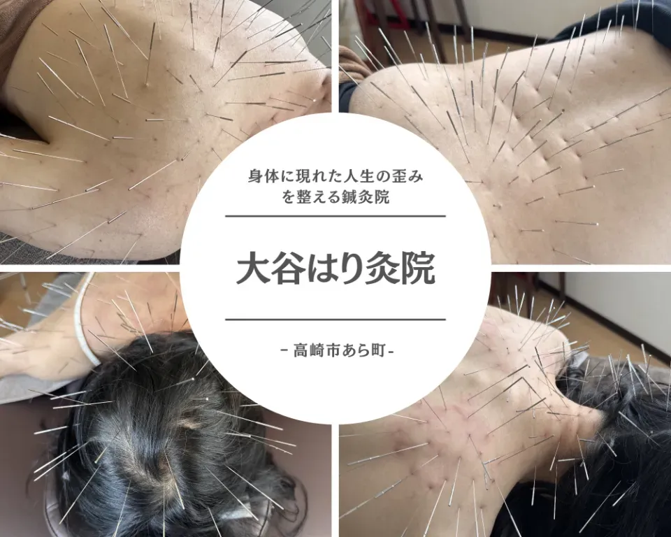 【身体の詰まり専門】大谷はり灸院｜高崎市