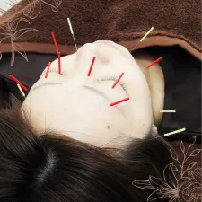 福岡美容鍼灸院canna 天神本院