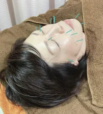 tete鍼灸庵