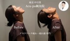 Acu-pa鍼灸院(アキュパ)