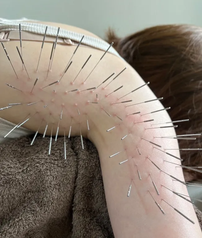 鍼style  女性専用ルート鍼治療院　