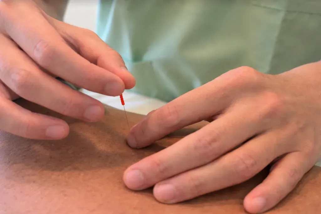 全身治療 まるっと鍼灸治療院