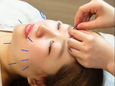 女性のための鍼灸サロンtete