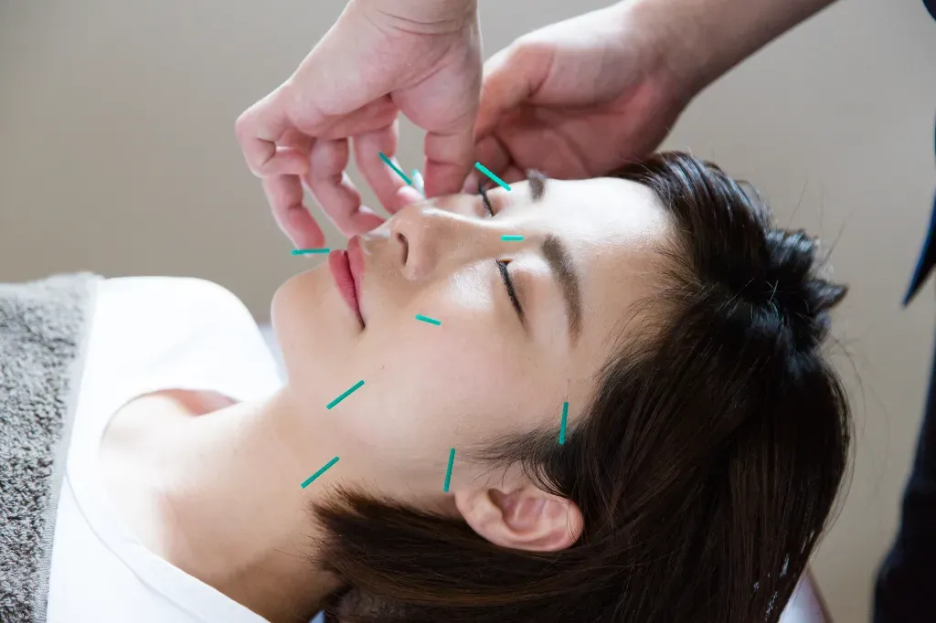 岡接骨院・鍼灸院