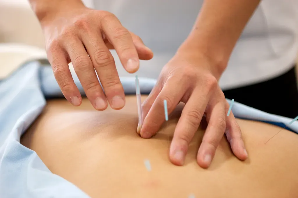 岡接骨院・鍼灸院