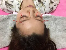 鍼灸サロン hari_eu