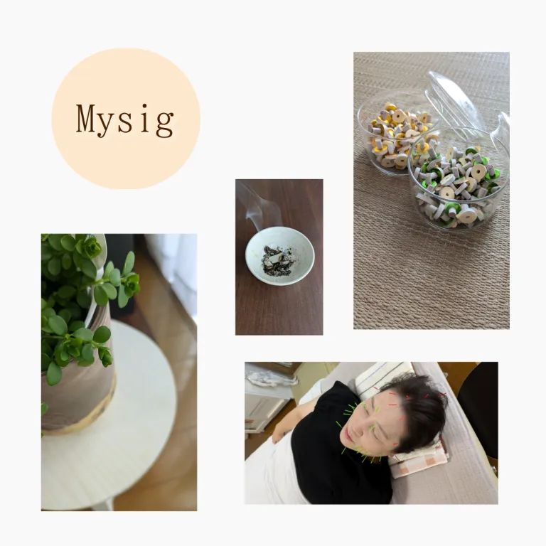 はり灸 Mysig