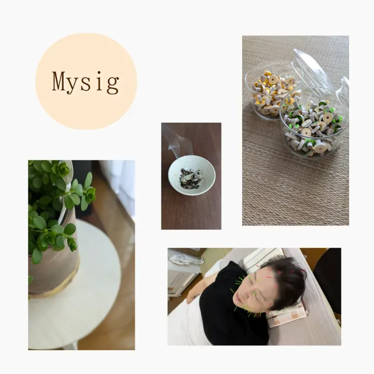 はり灸 Mysig