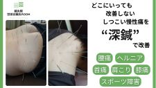 世田谷鍼灸ルーム