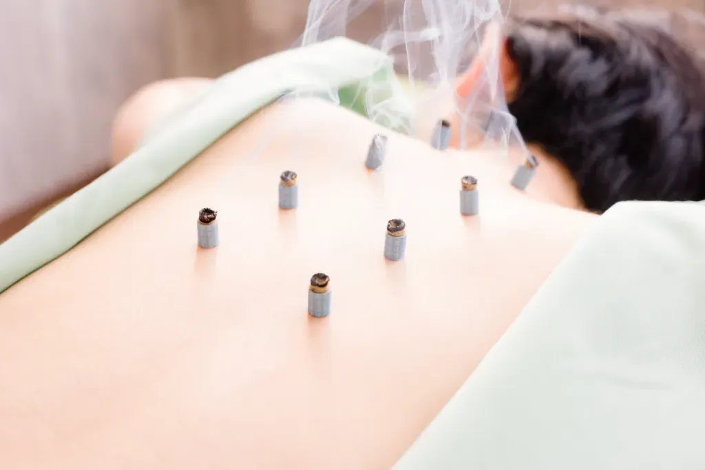 子宝鍼灸・美容鍼灸　くまがやリラックス鍼灸院