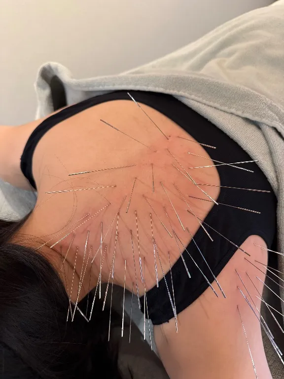 鍼灸&スポーツマッサージ Revive