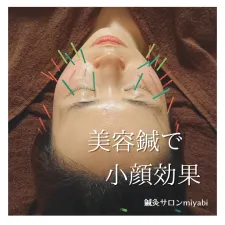 鍼灸サロンmiyabi