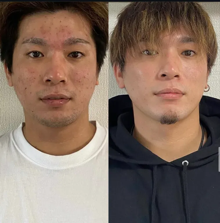 ひめの鍼灸院 博多大濠