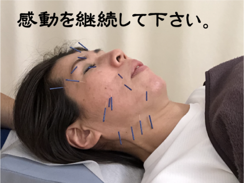 すみれ鍼灸整骨院のこだわりポイント