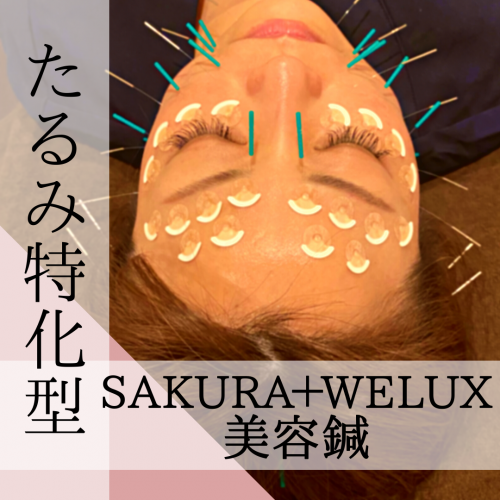 美容鍼灸サロンweluxのこだわりポイント