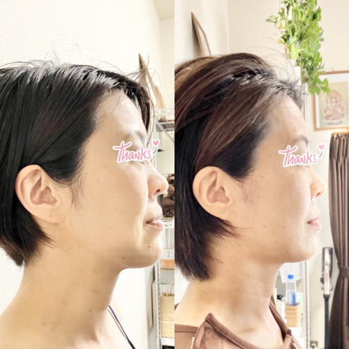鍼灸サロンれあ のこだわりポイント