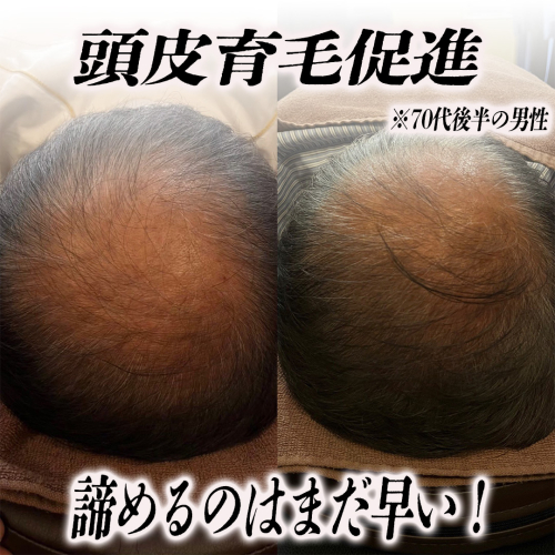 鍼処 紡ぐのこだわりポイント