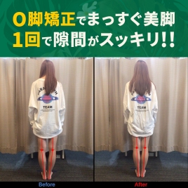 クシロ鍼灸整骨院 見た目で変化がわかるO脚矯正のメニュー画像