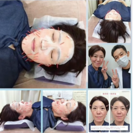 M.A.K.鍼灸整骨院 肌質改善（幹細胞美容鍼で美白美肌へ）のメニュー画像