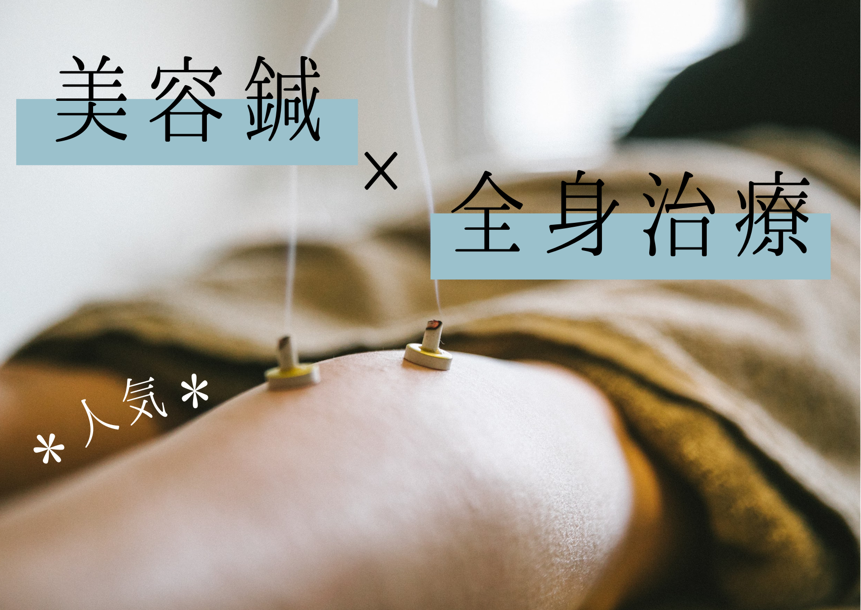 acune ✳︎✳︎1番人気✳︎✳︎からだから整える美容鍼〜ライト〜のメニュー画像
