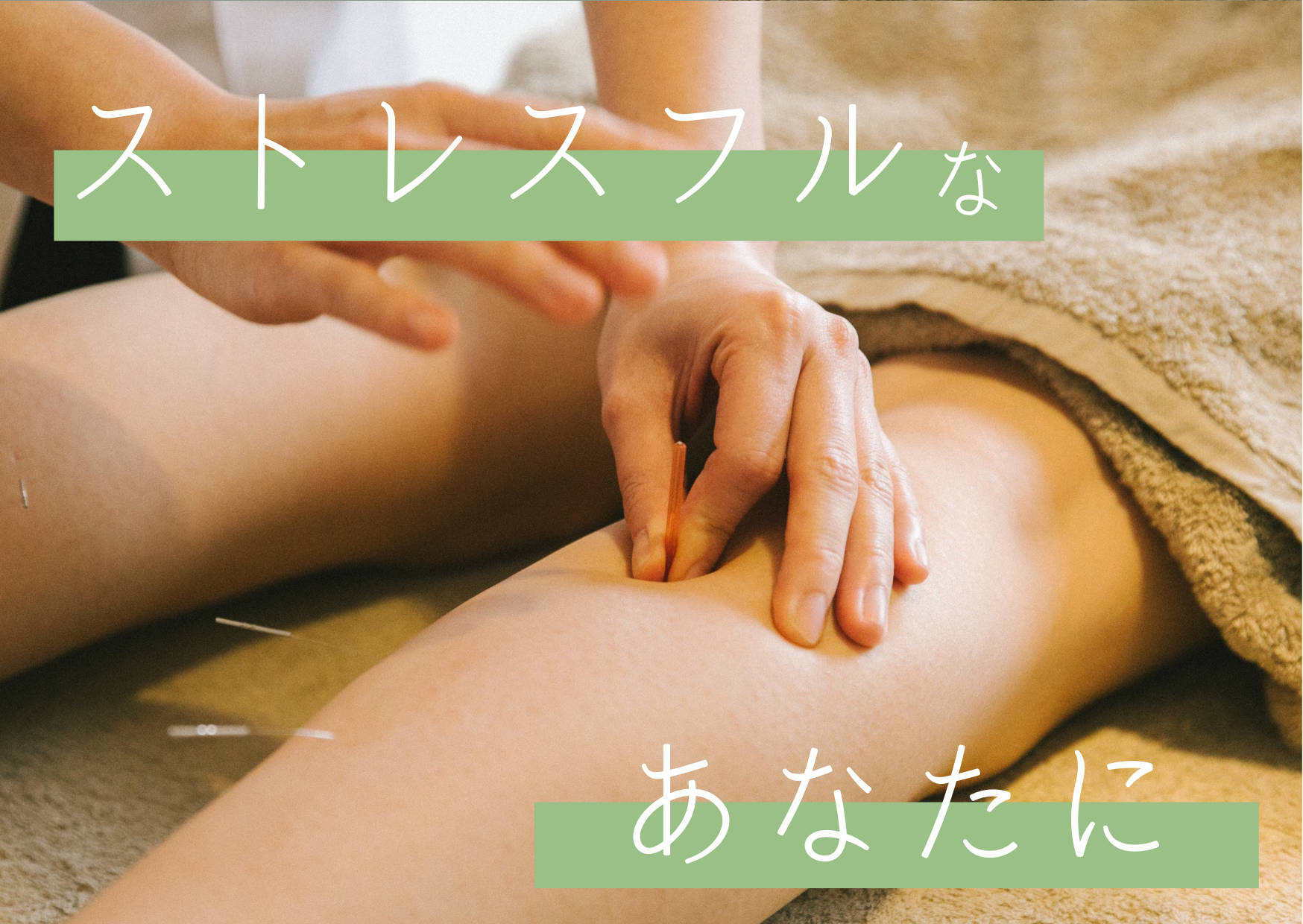 acune からだから整える美容鍼〜プレミアム〜のメニュー画像