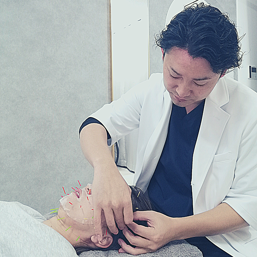 Acure鍼灸整体サロン **ご新規様限定**からだから整えるプレミアム美容鍼コースのメニュー画像