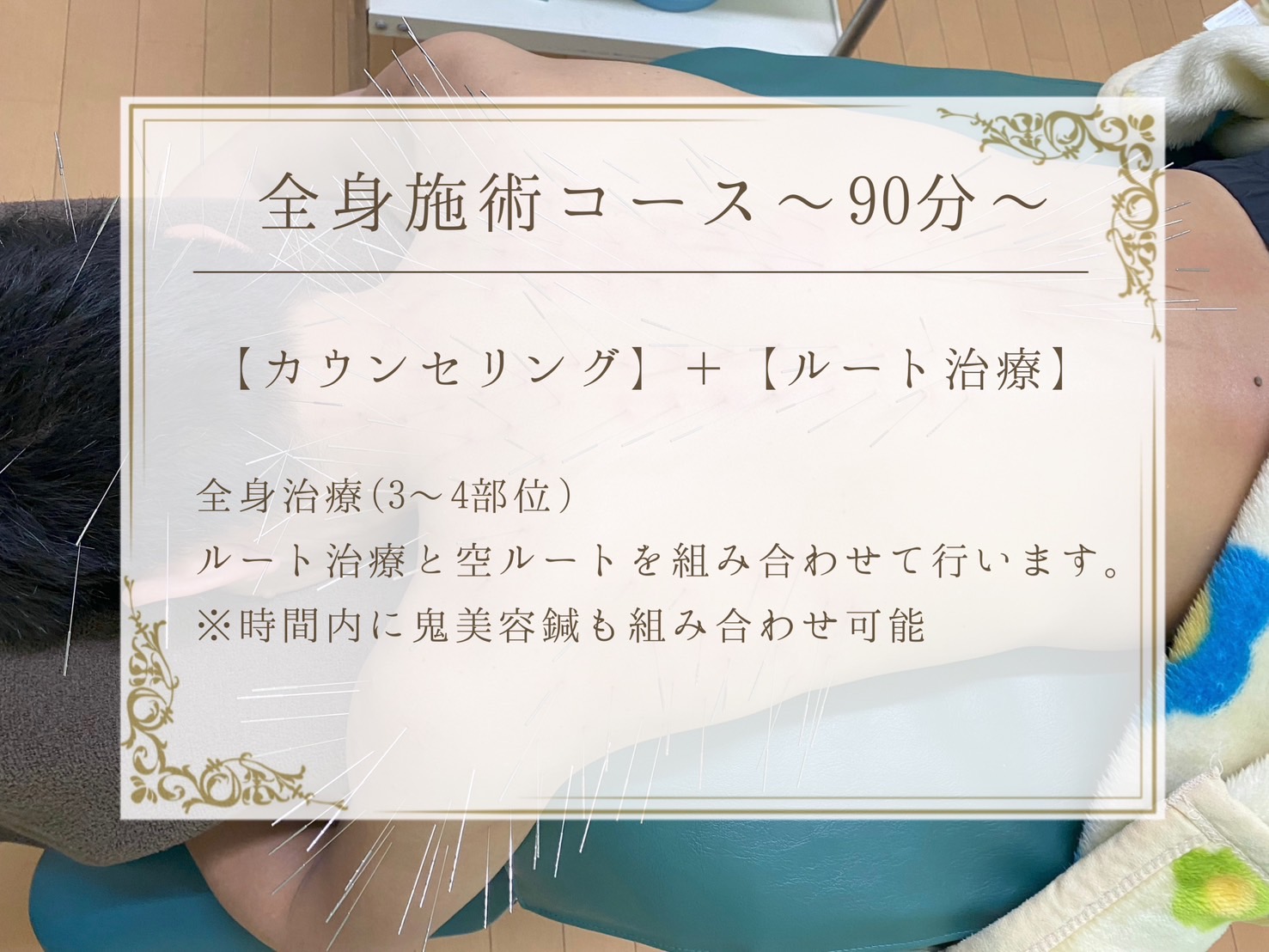 おおつか鍼灸接骨院～ルート治療認定院～ ルート治療　【　全身施術コース　 】のメニュー画像